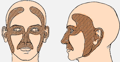 cirugia_Mohs_joaquin_nazar_anchorena