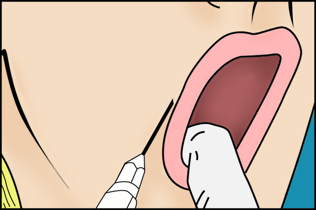 contorno_labios_joaquin_nazar_anchorena_02