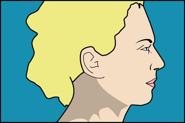 lifting_facial_joaquin_nazar_anchorena_04