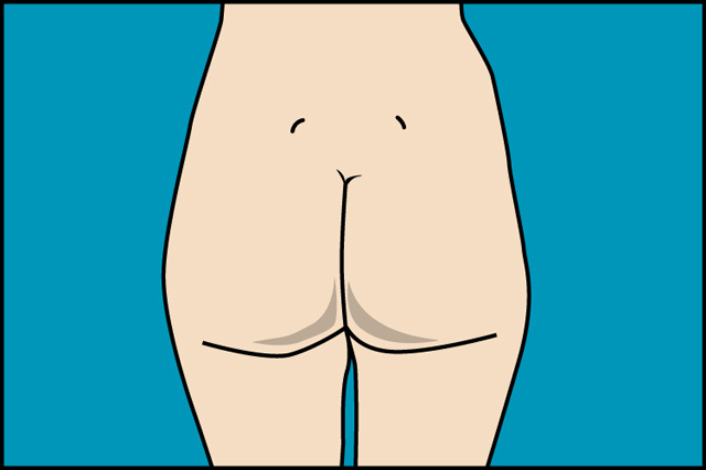 lipoaspiracion_joaquin_nazar_anchorena_04