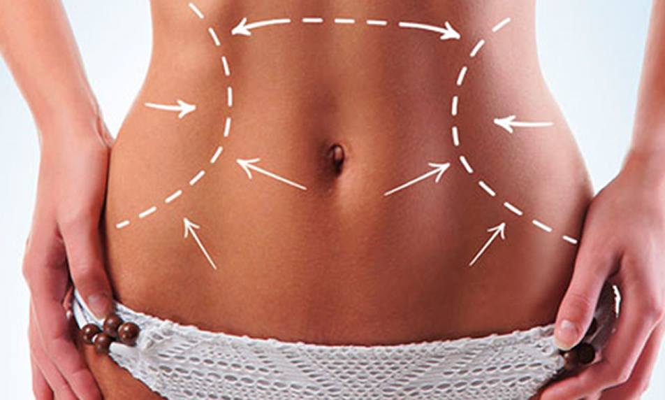Plástica abdominal