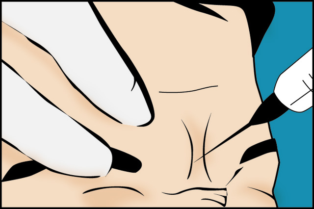 toxina_botulinica_joaquin_nazar_anchorena_01