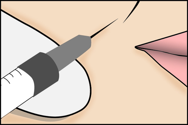 toxina_botulinica_joaquin_nazar_anchorena_02